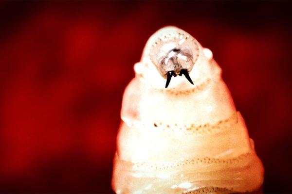 2 Deaths Reported in Parasite Cyclospora Outbreak…